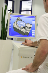 CEREC